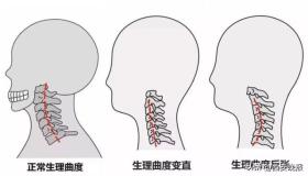 照片熱傳！不少年輕人在醫(yī)院“吊脖子”？醫(yī)生提醒  第4張