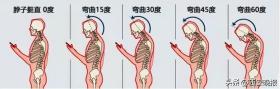 照片熱傳！不少年輕人在醫(yī)院“吊脖子”？醫(yī)生提醒  第6張